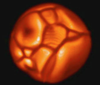 Computer image of a star that is made of different swollen cells that have some bright spots on them.